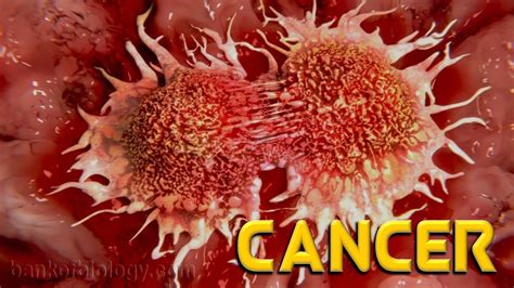 Human Health N Diseases Part 7 Cancer Types Causes Diagnosis And