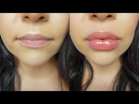 Incredible How To Make Your Top Lip Bigger Without Surgery Nutrition