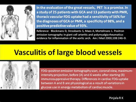 Vascular Blood Vessels