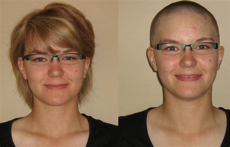 Before After Shaved Heads Pics Photo