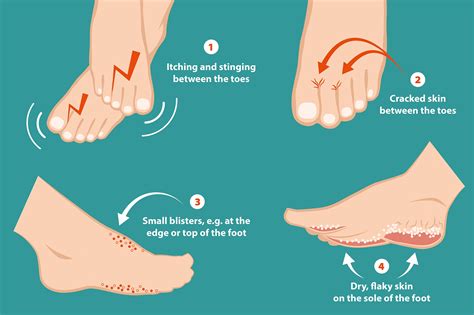 Treating Athletes Foot A Common Condition For Swimmers Bayer Global