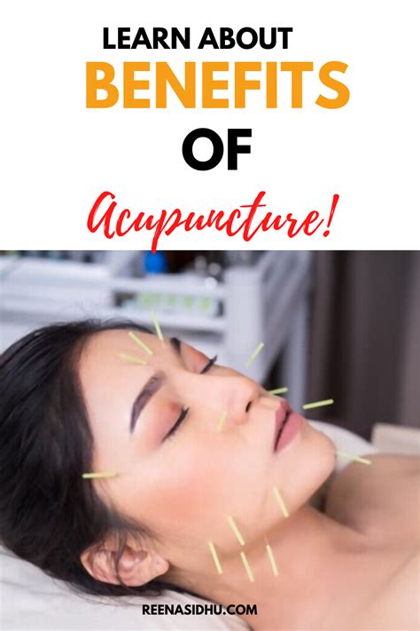 The Many Benefits Of Acupuncture In 2020 Acupuncture Benefit Health