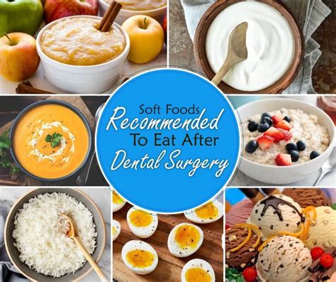 50 Soft Foods To Eat After Dental Surgery Easy Options Franklin