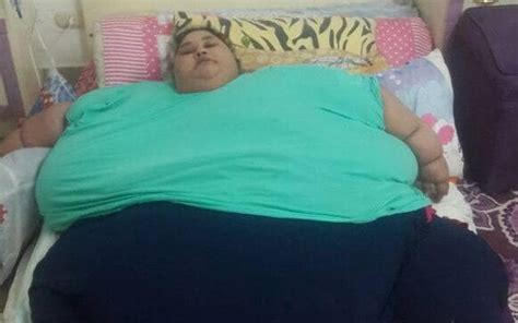 Worlds Heaviest Woman At 78st Undergoes Weight Loss Surgery