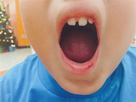 Mom Ymca Worker Duct Taped My Sons Mouth Closed