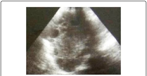 Ultrasound Showing Retrovesical Hydatid Cyst Download Scientific Diagram