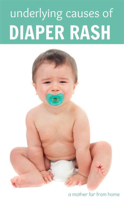 Common Diaper Rash Causes Diaper Rash Causes Baby Diaper Rash