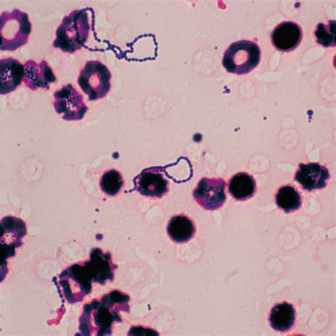 Streptococcus Viridans Adalah