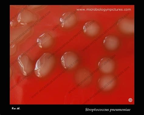 Virulent Mucoid Colonies Of Streptococcus Pneumoniae Streptococcus