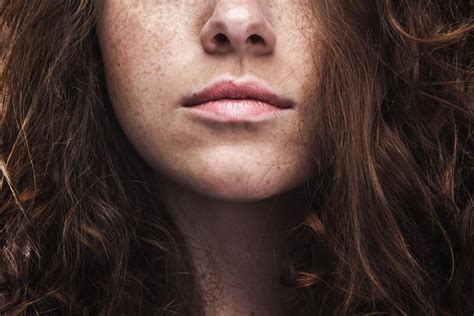 Freckles Causes Identification And Risks Women With Freckles