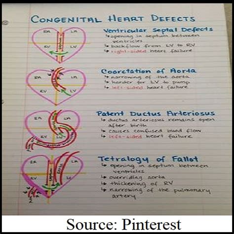 Congenital Heart Defects Causes Symptoms Diagnosis And Prevention
