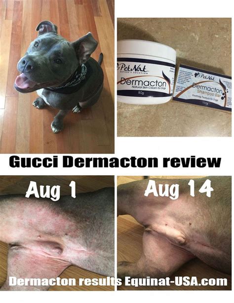 Dermacton Reviews All Natural Gentle Dermacton Products Have Helped