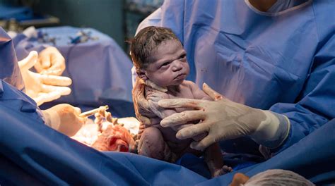 Newborn Makes An Epic Face In A Birth Photo That Went Viral She Is NOT