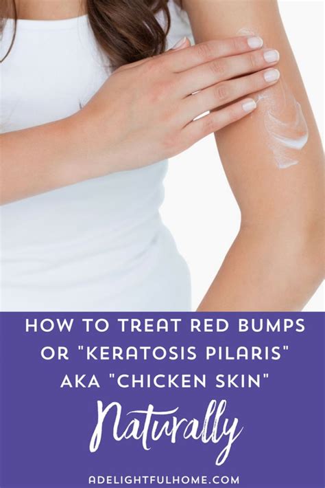 Natural Treatments For Keratosis Pilaris Aka Chicken Skin