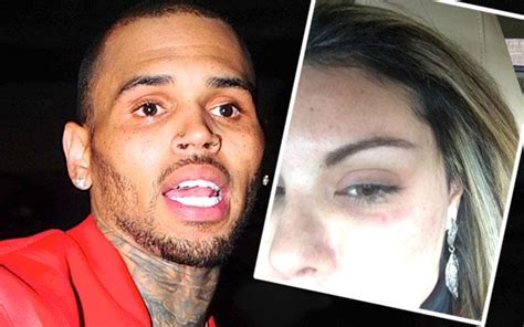 Chris Brown Accused Of Battering A Woman Again