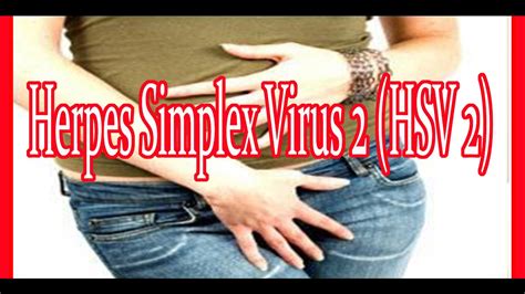 Herpes Simplex Virus 2 Genital Herpes Herpes Treatment