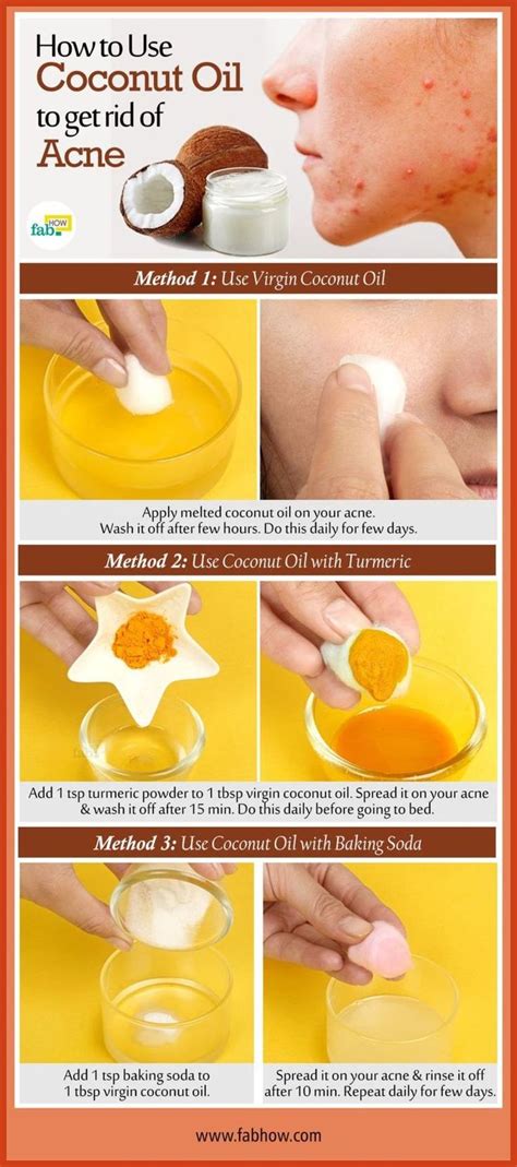 Homemade Acne Remedies Alternative To Acne Care At Home Acne Remedies Check Out This Gre