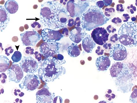 Effusion Cytology Clinicians Brief