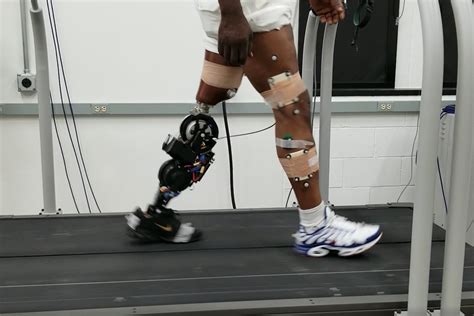 Energy Efficient Robotic Prosthetic Legs For A Natural Walk Mediworld