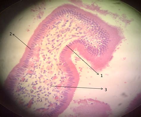 Primeros Pasos En Medicina Epitelio Cilíndrico Simple