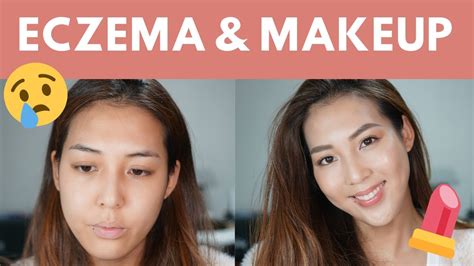 My Eczema Journey And How To Apply Makeup On Flare Up Days Youtube