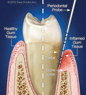 When To See A Periodontist Dear Doctor Magazine