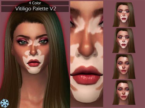 Sims 4 Vitiligo Hair