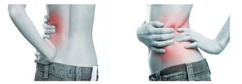 Kidney Pain Location Anatomy Causes Stone Pain Relief Symptoms