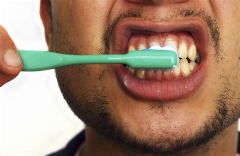 Hydrogen Peroxide Hacks Youll Wish You Had Known Sooner Gum Disease