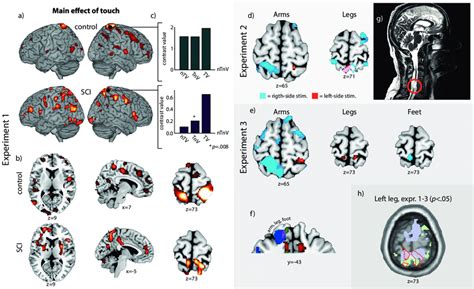Overview Of Functional Magnetic Resonance Imaging Fmri Results A