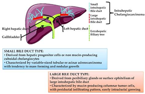 Wk Biliary Tree Pathology Diagram Of Biliary Tree Abd Mod My Xxx Hot Girl