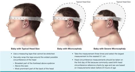 Measuring Head Circumference Richmond Hill Childrens Clinic