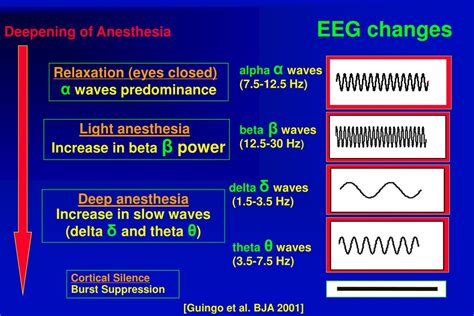Ppt Bispectral Index Depth Of Anesthesia Monitoring Powerpoint