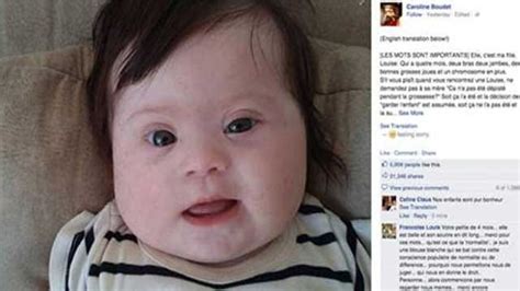 Moms Facebook Post On Down Syndrome Goes Viral