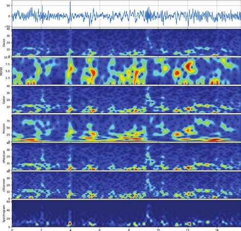 Scalogram And Spectrogram Of A Segment Of Signal Channel Eeg Signal