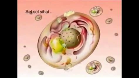Pengertian kista ovarium — kista ovarium adalah kantong berisi cairan yang tumbuh pada indung telur (ovarium) wanita. Kandungan Utama Jelly Gamat Luxor - YouTube