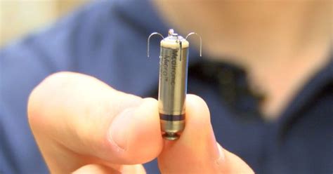 Worlds Smallest Pacemaker Available In Kc