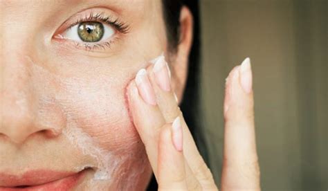 Heres How You Get Rid Of Blackheads On Inner Thighs Makeover Momma