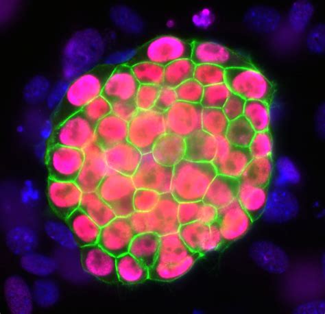 Image Gallery Stem Cells And Regeneration Stem Cells Cell