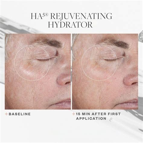 Skinmedica Ha5 Rejuvenating Hydrator Save An Addl 20 Now