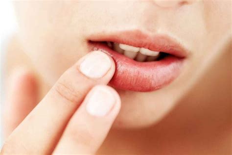 Symptoms Of Allergic Reaction To Lipstick