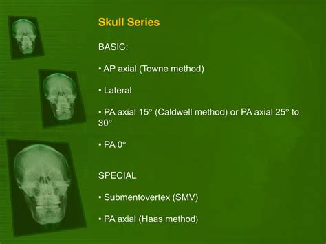 Ppt Positioning Of The Skull Powerpoint Presentation Free Download