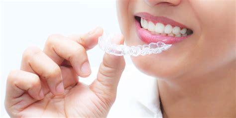 Removable Invisible Aligners Partha Dental Clinic 130