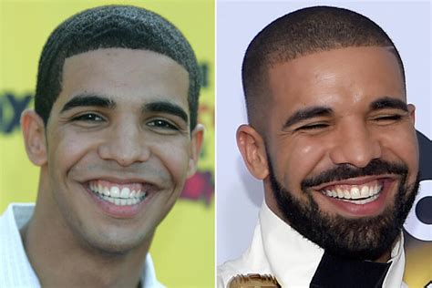 10 Celebs With And Without Beard What Do You Think Which One Is