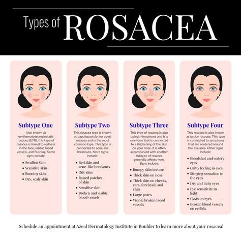 Skin Care Regimen For Rosacea Beauty And Health