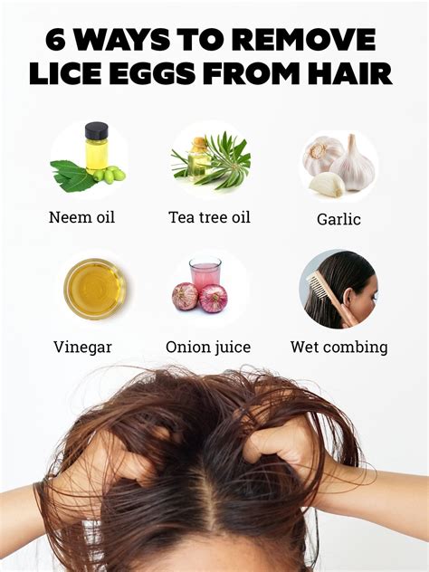 Heres How To Remove Lice Eggs From Hair Using Home Remedies Be