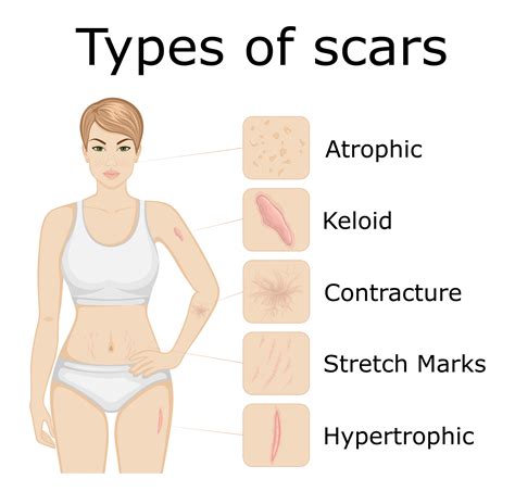 Understanding And Treating Scarred Skin Thirdage