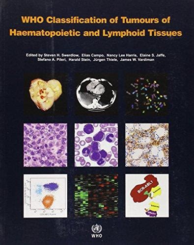 Who Classification Of Tumours Of Hematopoietic And Lymphoid Tissues 4th