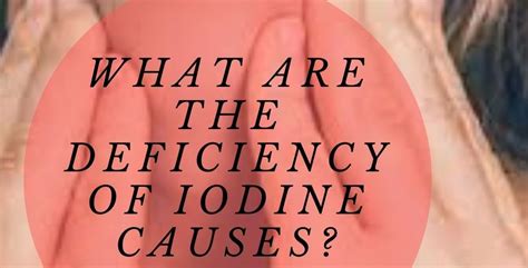 what are the deficiency of iodine causes my medi times