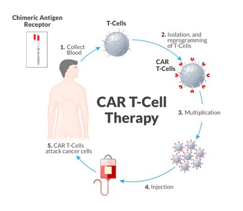Car T Cell Therapy Cfch Centre For Clinical Haematology